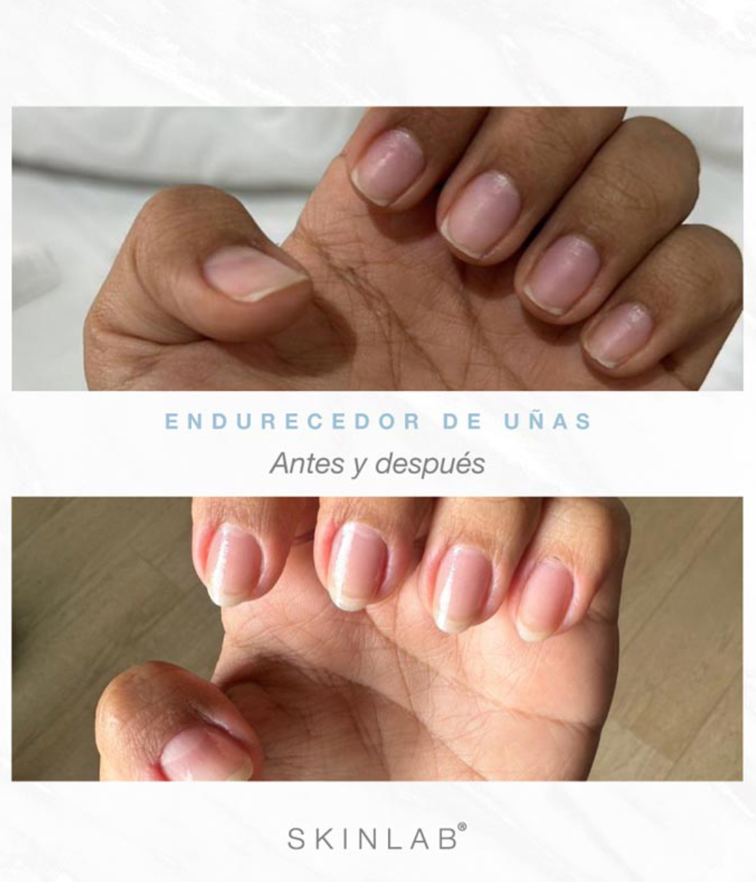 ENDURECEDOR DE UÑAS – NAIL STRENGTHENER SKINLAB 13 ML.
