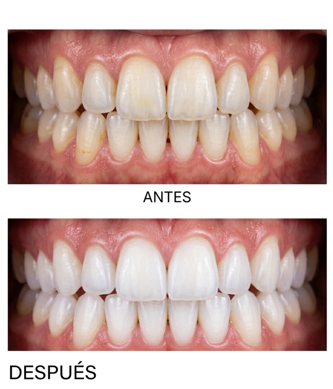AP 24 WHITENING FLUORIDE TOOTHPASTE –  NU SKIN 110 GRMS.